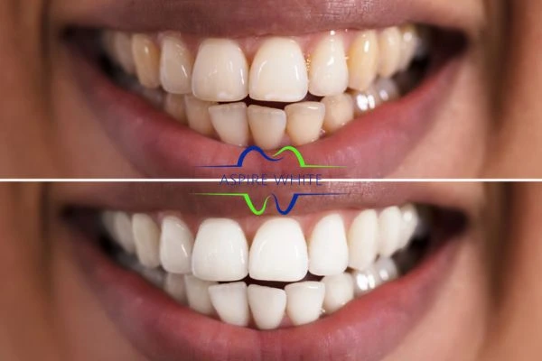 Aspire White customer before and after Cheltenham results.