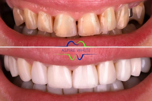 Before And After Results Cheltenham